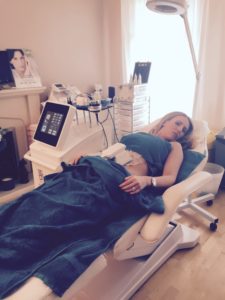 Female having 3D Lipo