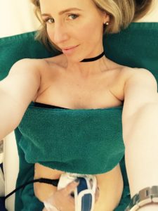 Patient having 3D lipo treatment