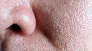Close Up Image of Face Pores