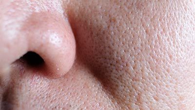 Large Pores