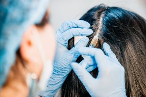 prp treatment hair restoration