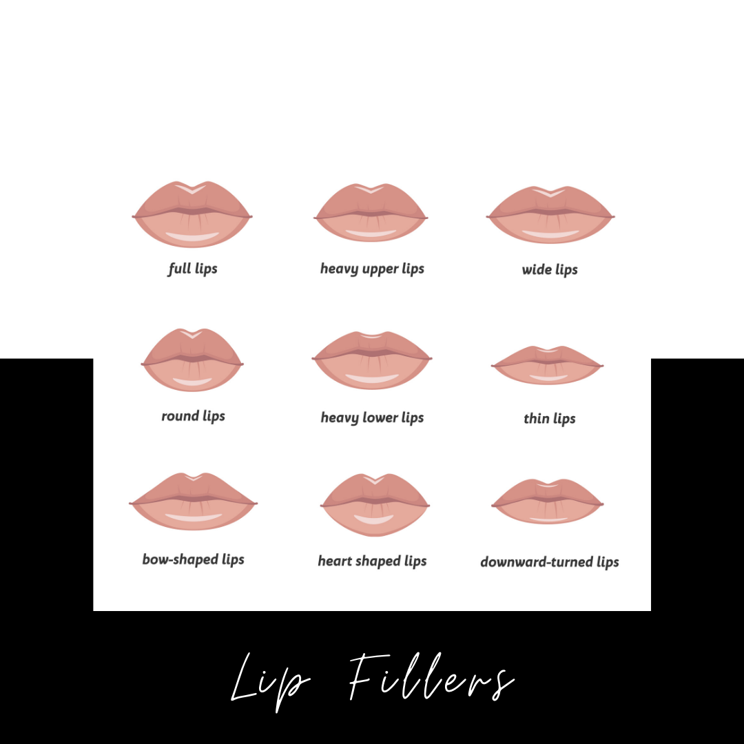 Fillers for Lips Before and After