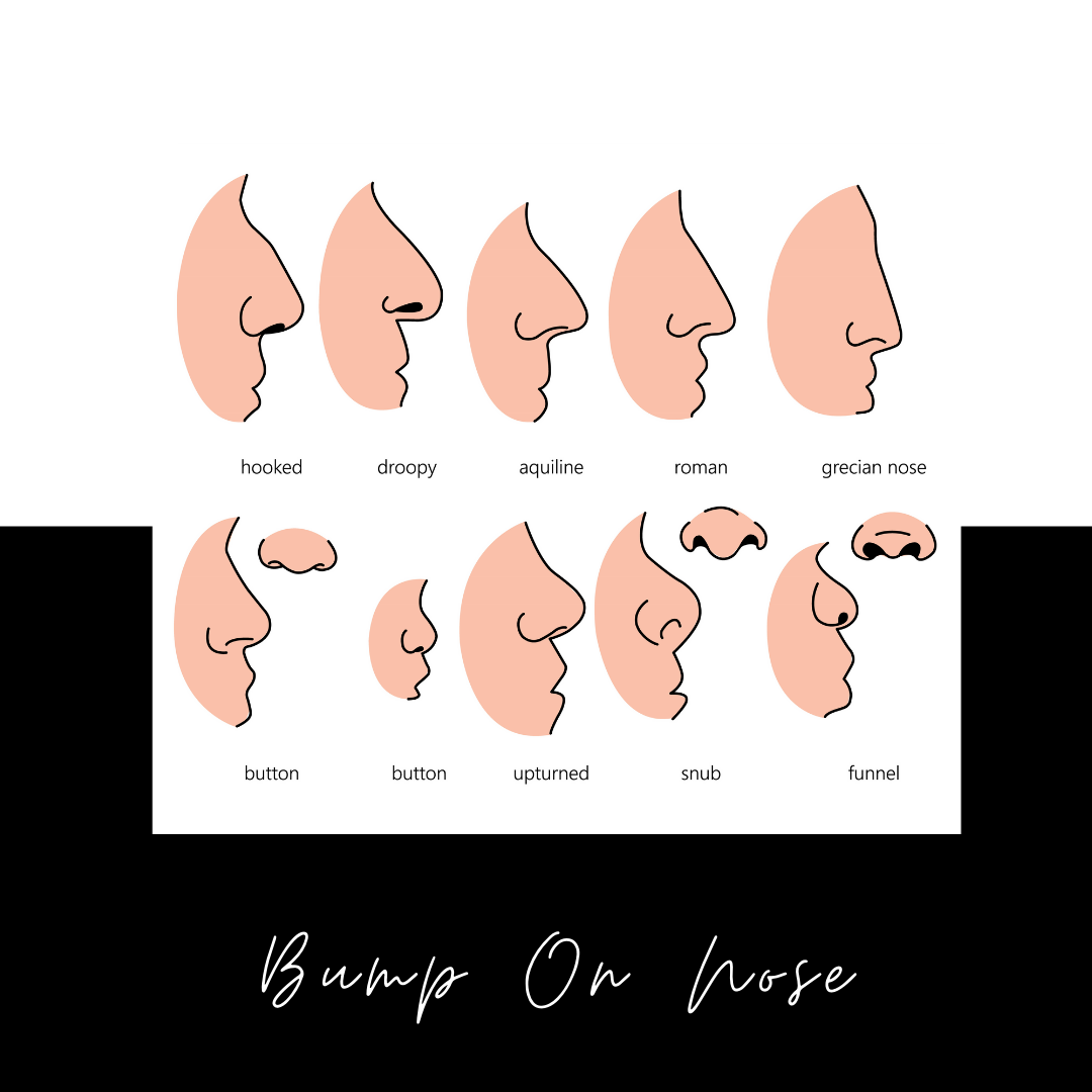 5 Nose Problems Non Surgical Nose Jobs Can Fix