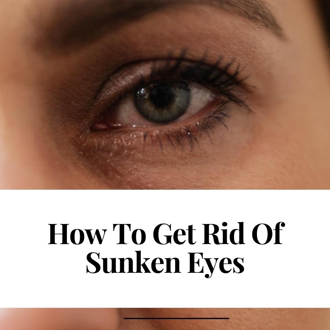 How To Get Rid Of Sunken Eyes