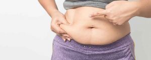 Fat Freezing Treatment