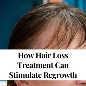 How Hair Loss Treatment Can Stimulate Regrowth-2