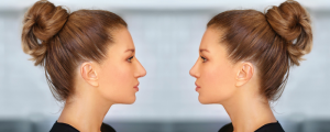 Liquid Rhinoplasty