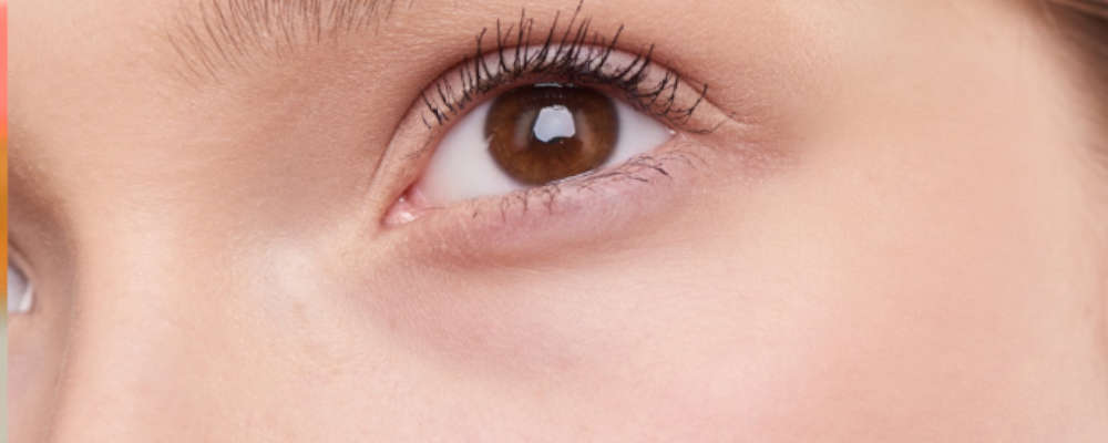 Eye Thread Lift_ Everything You Need To Know(1)