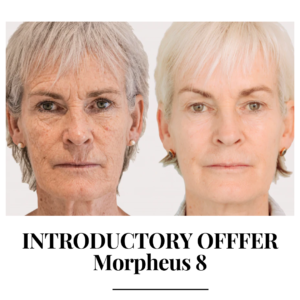 Morpheus 8 Introductory Offer