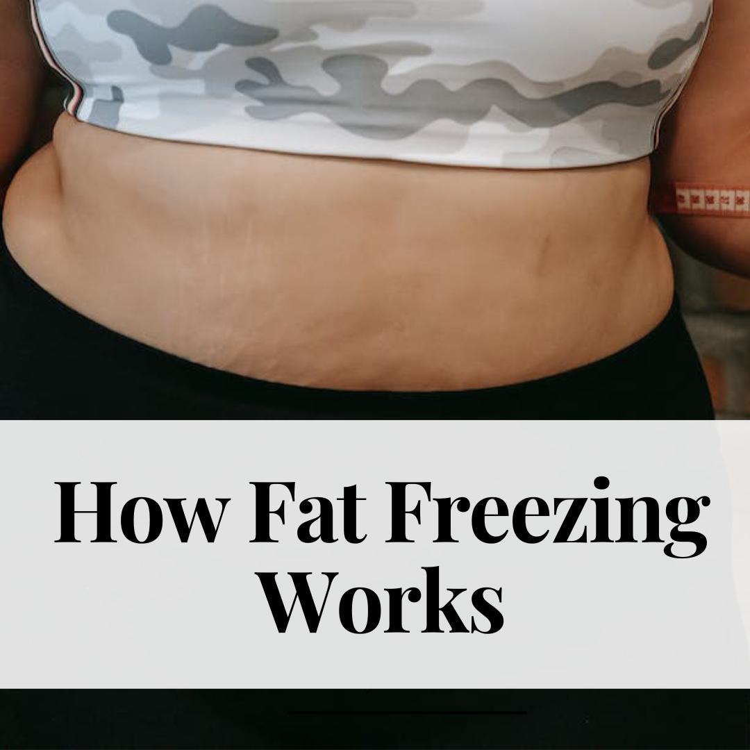 How Fat Freezing Works
