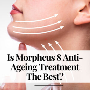 Is Morpheus8 Anti-Ageing Treatment The Best?