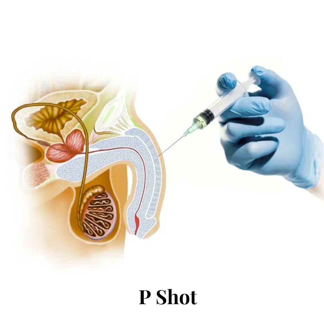 P Shot Birmingham – Why Many Men Choose to Travel to London for Expert Treatment