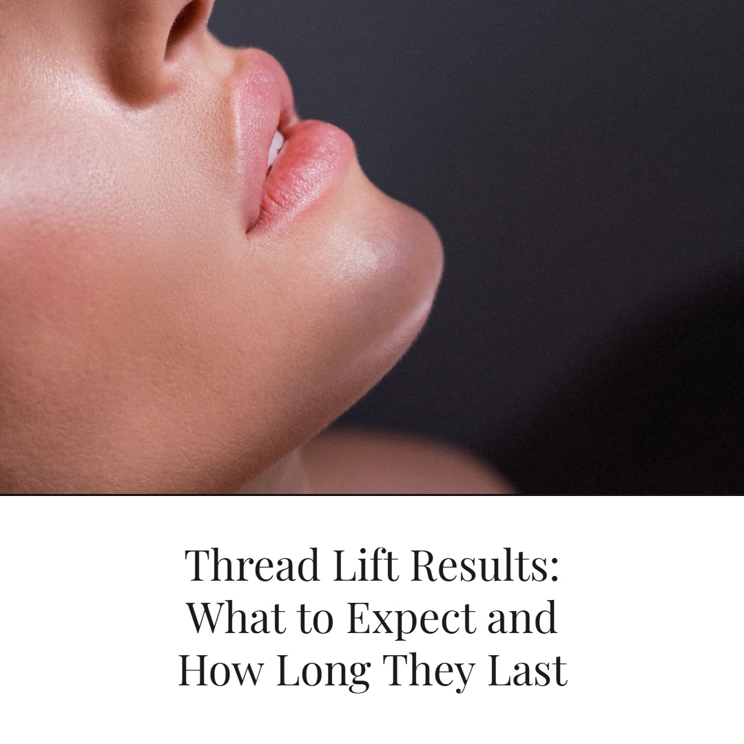 Thread Lift Results: What to Expect and How Long They Last